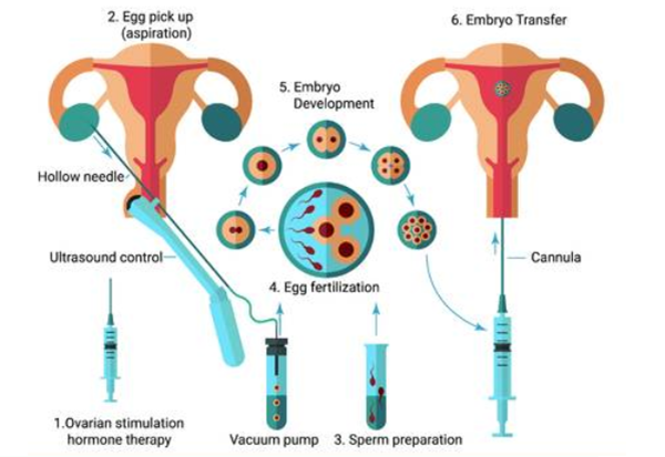 兰州结扎手术医院