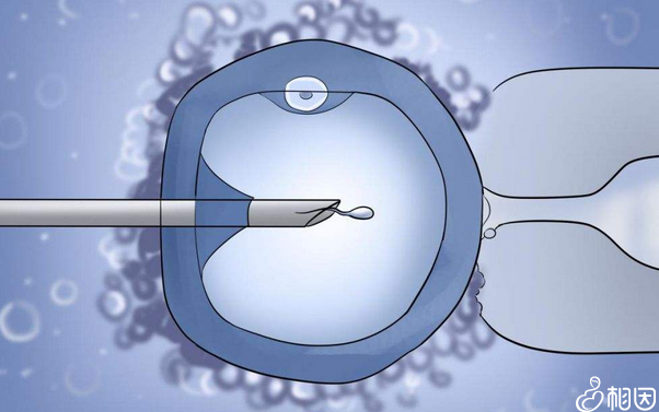 六盘水捐卵试管生男孩